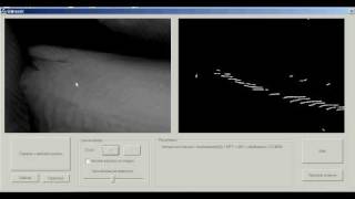 Automated Detection of Fish Bones in Salmon Fillets using X-ray Testing