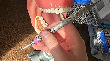 How To Use the Barnhart Universal Curet