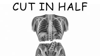What Getting Cut in Half Feels Like