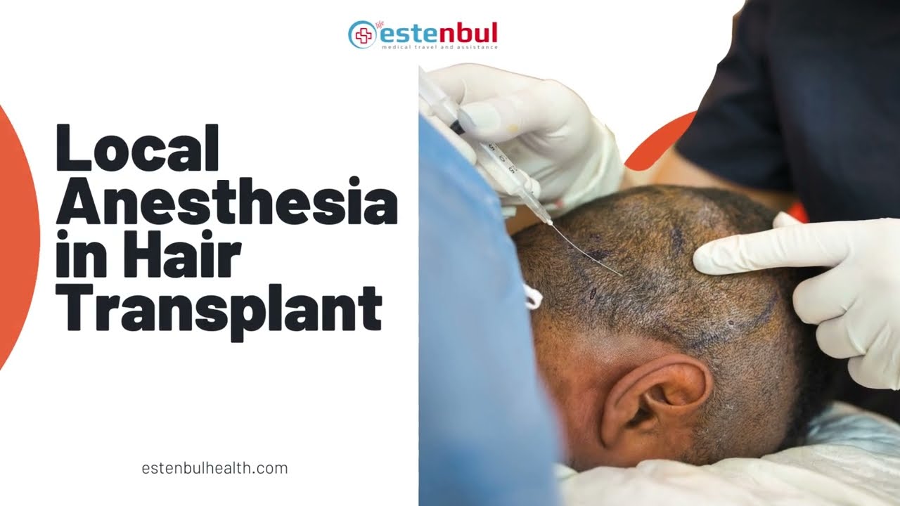 Local Anesthesia in Hair Transplantation (Needle-Free Anesthesia) - YouTube