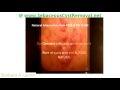 Sebaceous Cyst Removal At Home Barbara A Lamm Sebaceous Cyst Removal At Home Barbara A Lamm