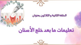 32 تعليمات ما بعد الخلع