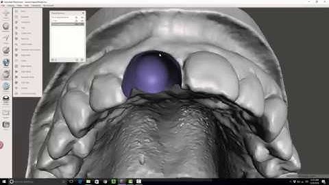 Creating an Ovate Pontic Site