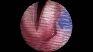 Marco Fantini-6
