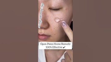 😱Viral Open Pores Home Remedy/Open Pores Treatment #shorts #skincare #youtubeshorts Anamika Barai