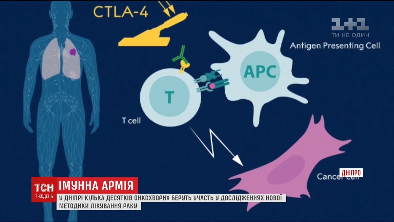 У Дніпрі кілька десятків онкохворих беруть участь у дослідженнях нової методики лікування раку