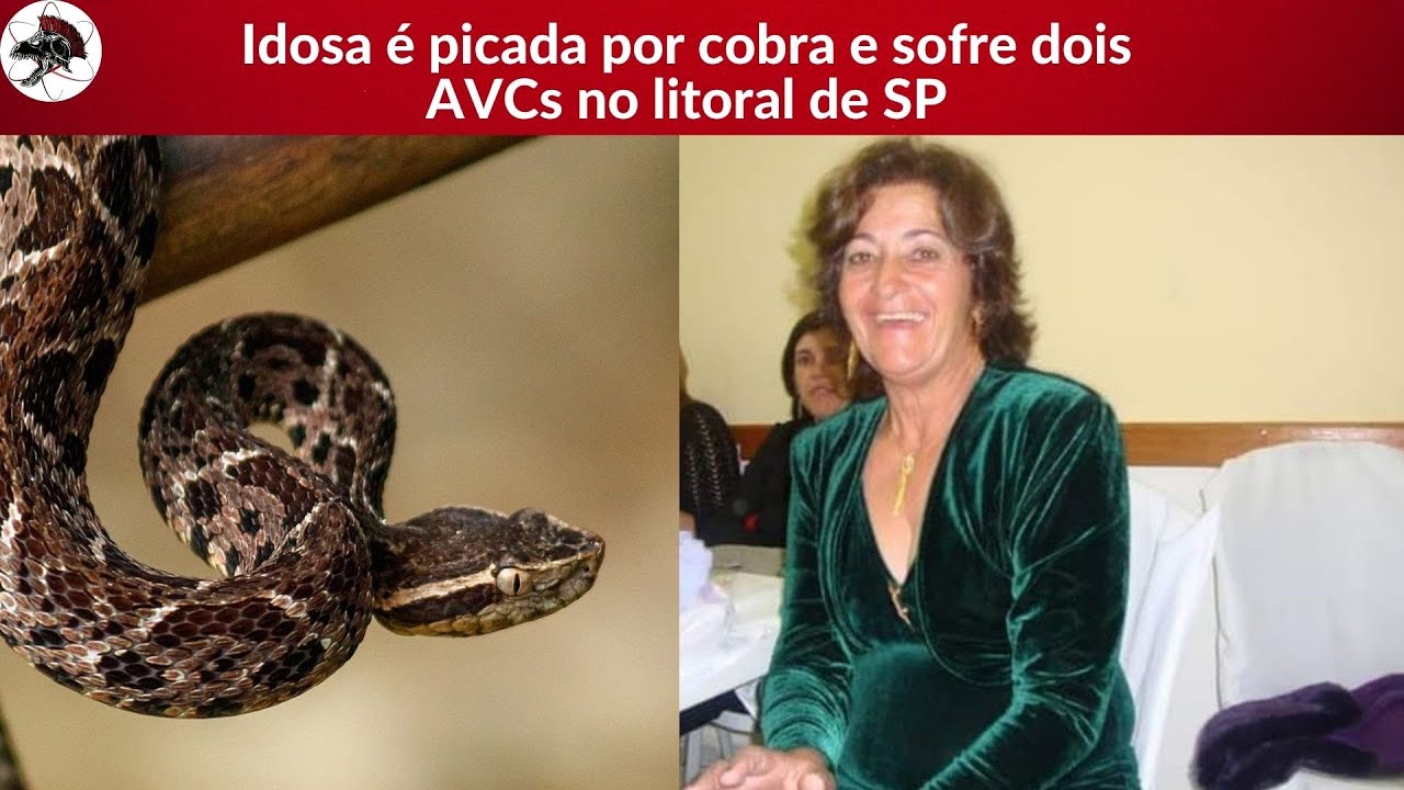 Idosa picada por Cobra sofre dois AVCs no Litoral Paulista | Biólogo Henrique