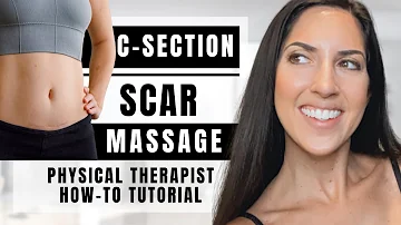 How To Do C-Section Scar Massage | Physical Therapist | Get Rid of C-section Pouch + Scar Tissue