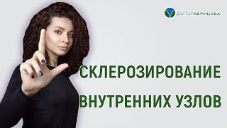 Склерозирование внутренних узлов. Проктолог женщина в Москве
