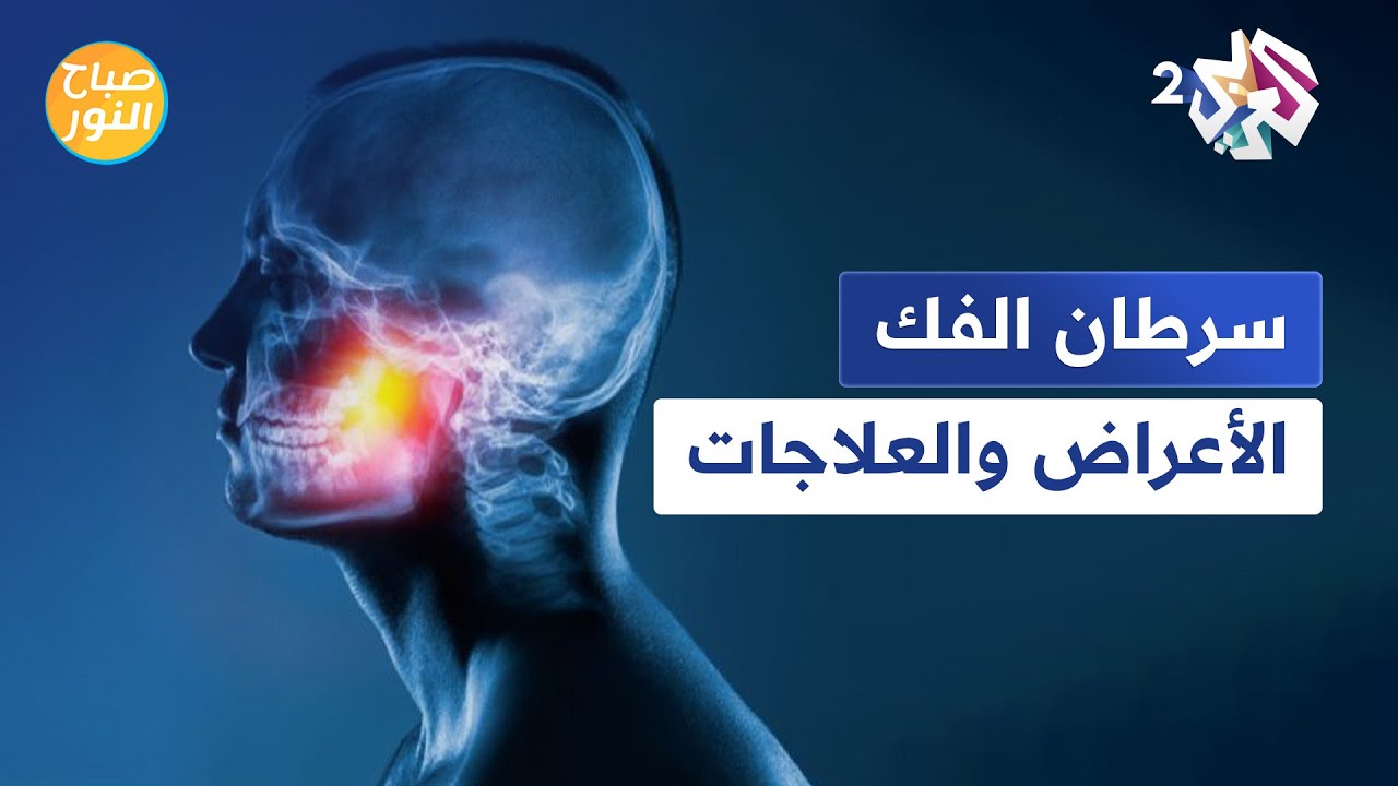 سرطان الفك .. الأعراض والمخاطر والعلاجات