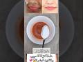 وصفة رائعة لإزالة حبوب وتبييض البشرة الوجه اكسبلور Musica Beauty Love 