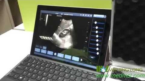 Stable Wireless color doppler Convex probe for Android tablet