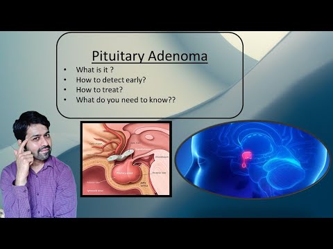 Video: Pituitary Adenoma - Symptoms, Treatment, Removal In Men