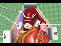 Aortic Valve Replacement Surgery Animation by Cal Shipley, M.D.