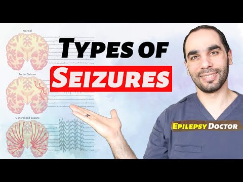 How do I know if I am having seizures? will be surprised they were even seizures