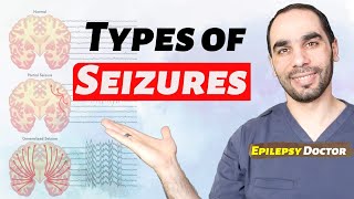 How to know if you have Epilepsy, different seizure types