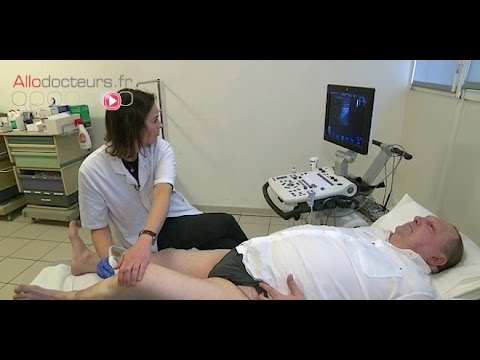 Vidéo: Douleur Dans Les Veines Des Jambes