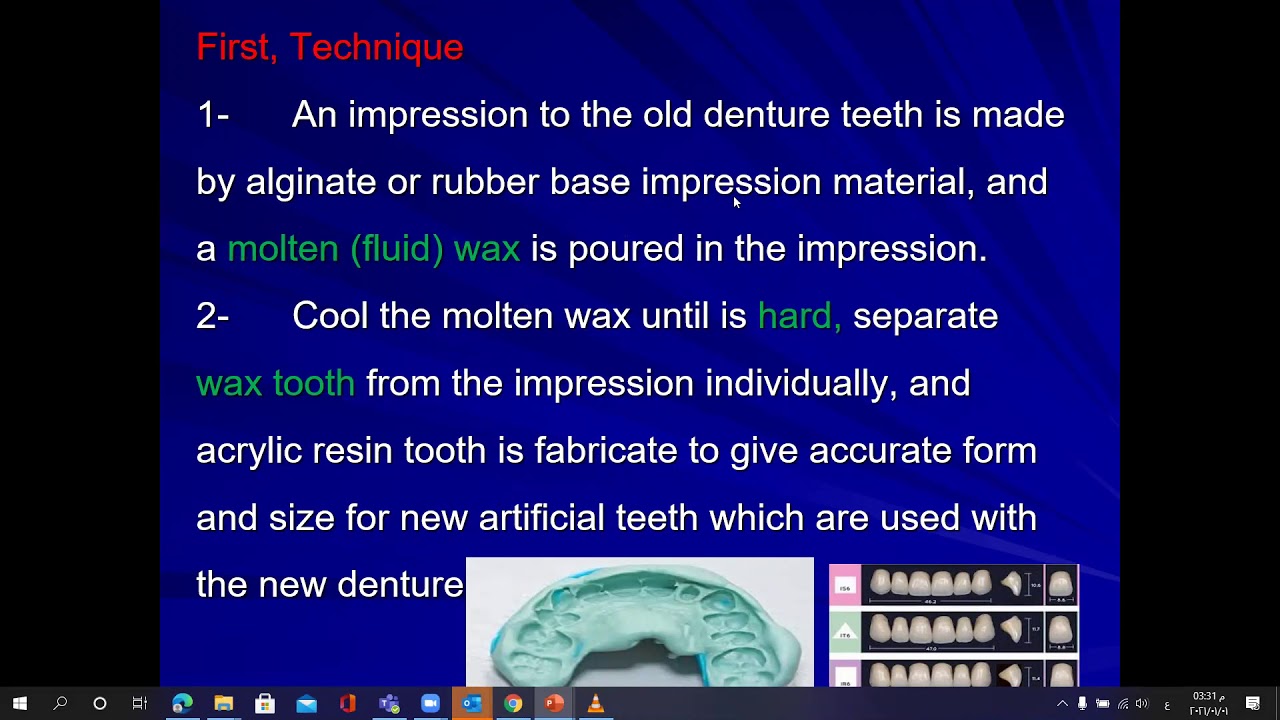 duplication of complete denture