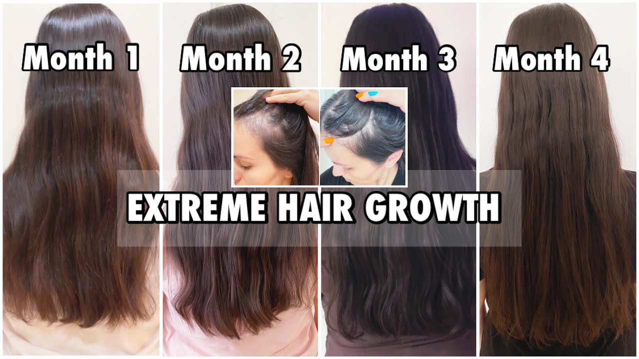 HOW TO GROW YOUR HAIR LONG FAST | BEFORE AND AFTER PICTURES - thptnganamst.edu.vn