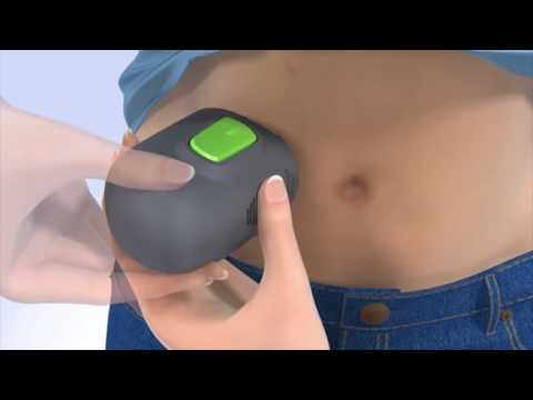 Medtronic - How to insert the Guardian Connect CGM?