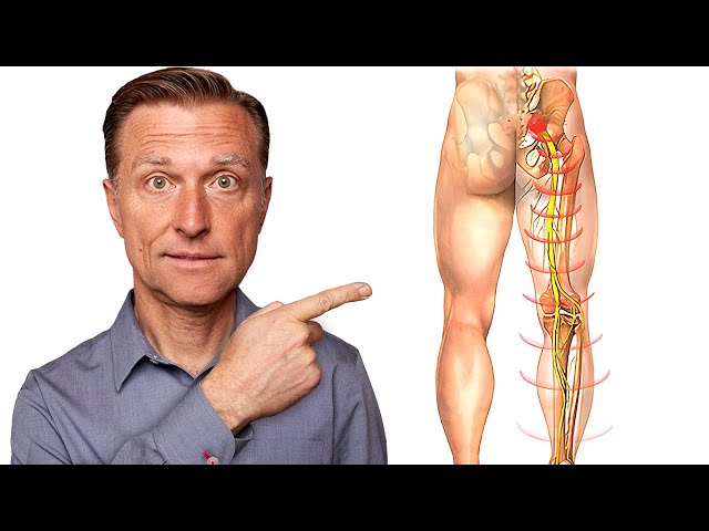 Say Goodbye to Sciatica Nerve Pain in 5 Minutes class=