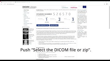 DICOM Library: upload, anonymize, view, share and download anonymized DICOM files online