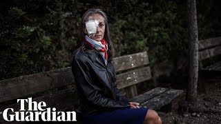 'I could have died': Ryder Cup spectator blinded in one eye