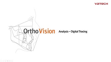 [simple tutorial 02]  Analysis Digital Tracing