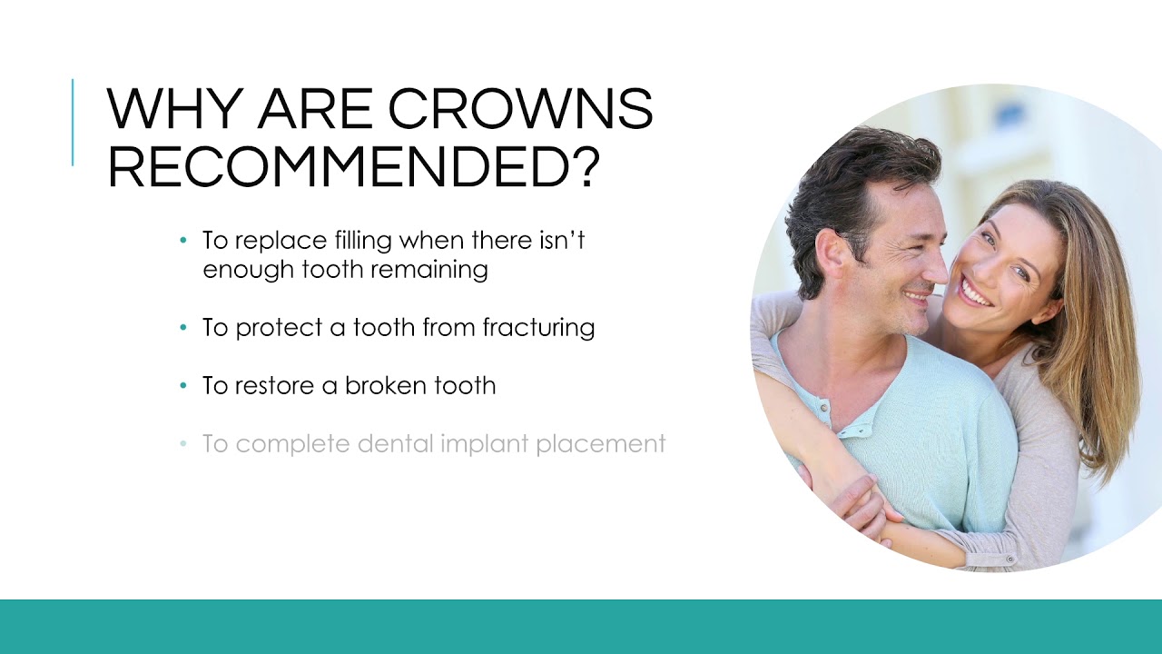 Belleville WI Dental Crowns - Dentist in Sugar River