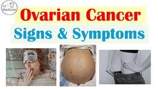 Ovarian Cancer Signs & Symptoms