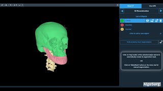 #AI-based segmentation and 3D modelling for Maxillofacial Surgical Applications