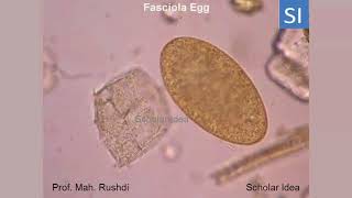 Fasciola egg