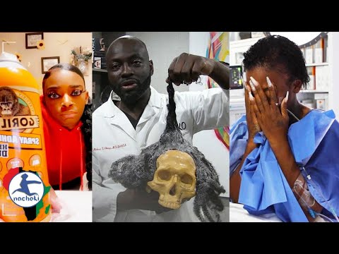 Ghanaian Surgeon Dr Obeng Saves African American Woman Who Gorilla Glued Hair