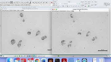 Calculando Oil Red-O - ImageJ