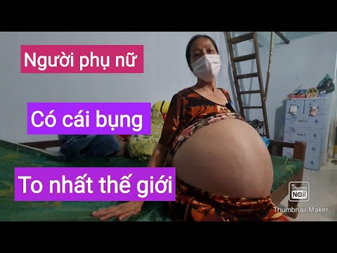 Video: Làm Thế Nào để Không Phản ứng Với Sự Thay đổi Tính Cách Của Phụ Nữ Mang Thai