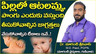 Chickenpox Symptoms Treatment In Telugu Measles Dr Maganti Srinivas ఆటలమమ పగ