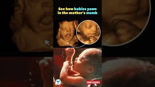 ?Observing Fetal Yawning: Fascinating Womb Behavior ? pregnancy fetaldevelopment womb shortsfeed