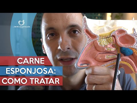 Carne Esponjosa: Entenda de uma vez o que é e quais os Tratamentos