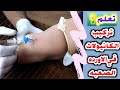 شاهد تركيب كانيولا في وريد ضعيف جدا_ مع وائل جمال للتمريض Professional cannula installation