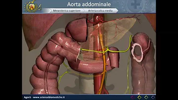 Quando l'addome pulsa?