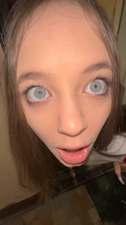 Аллергия YouTube