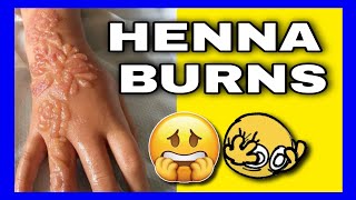 Can henna burn your skin😱\how to choosebest bridal hennamehndi cone#hennaburn #choosingbesthennacone