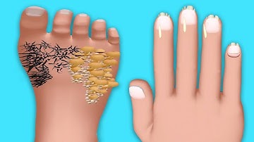 Beauty Care - Gameplay Walkthrough - All Levels (IOS, Android)