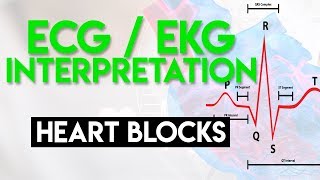 Heart Blocks Made Easy | ECG EKG Interpretation (Part 6)