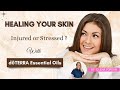 Healing Your SKIN Injured Or Stressed With DōTERRA Essential Oils Healing Your SKIN Injured Or Stressed With DōTERRA Essential Oils