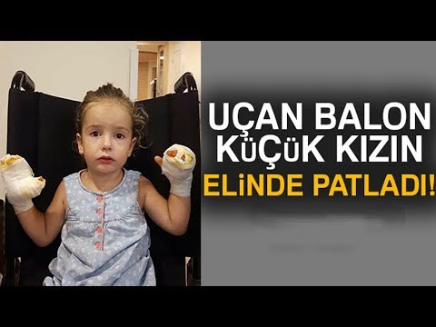 Uçan Balon Küçük Kızın Elinde Patladı