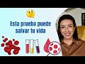 Esta prueba puede SALVAR tu VIDA HbA1c