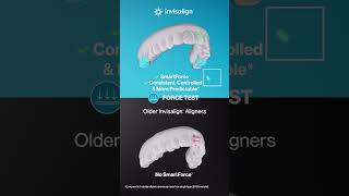 The world’s most advanced clear aligner.