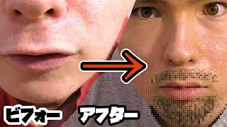 Pds 1ヶ月ヒゲを放置してみた 検証 Pds サムネイル画像 Youtuberコメ速報 Pds 1ヶ月ヒゲを放置してみた 検証 Pds サムネイル画像 Youtuberコメ速報