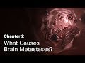 What Causes Brain Metastases? Chapter 2 — Brain Metastases: A Documentary